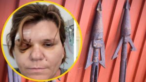 Româncă atacată de un vecin italian Pteronela Codreanu Sassari